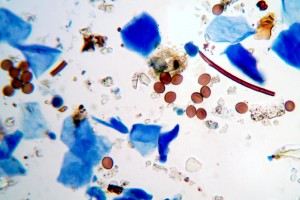 mold spores and skin cells