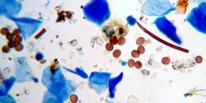mold spores and skin cells